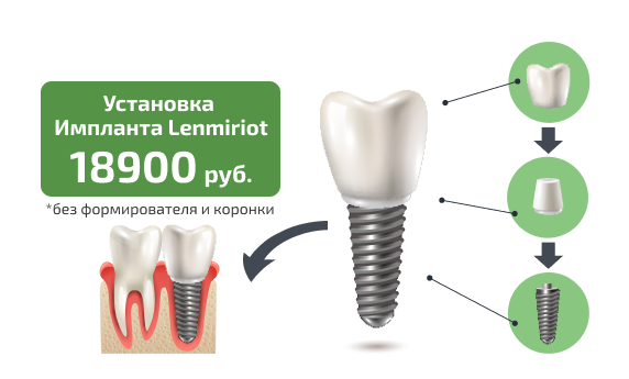 Импланты Lenmiriot